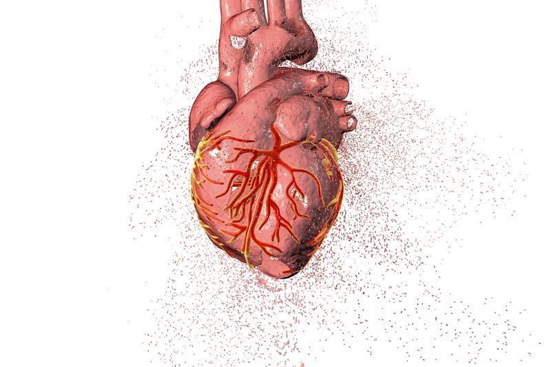 What is Heart Disease and is it Preventable?